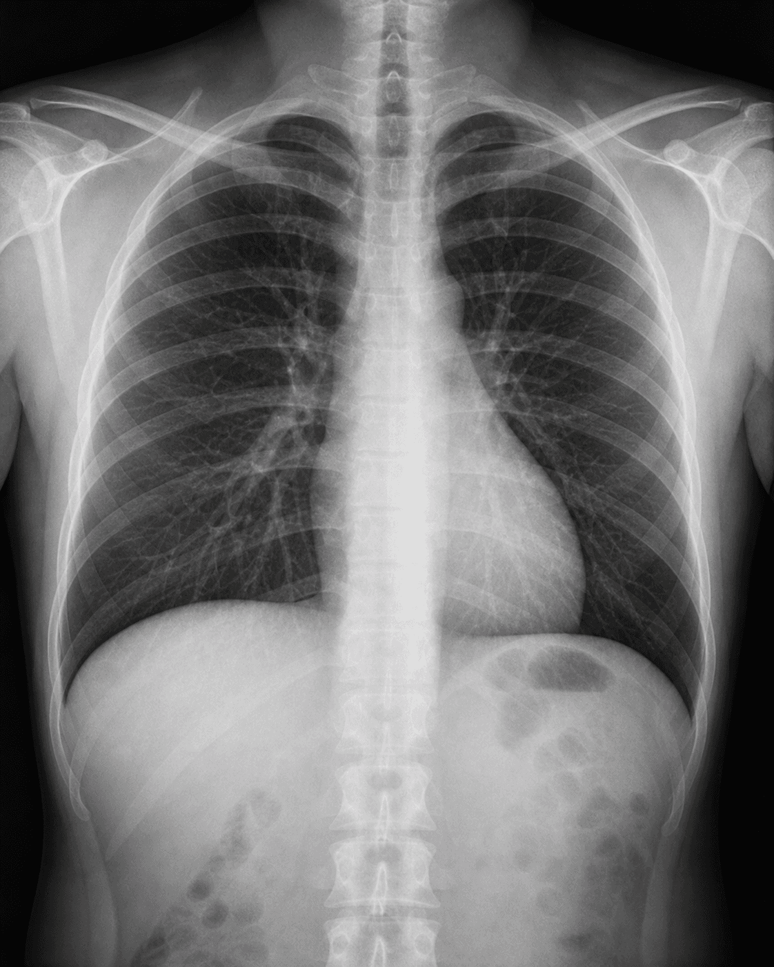 Illustrative synthetic chest radiograph in a fictional image viewer